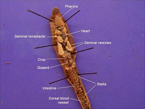 earthworm dissection labeled